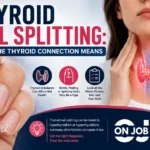 Thyroid Nail Splitting