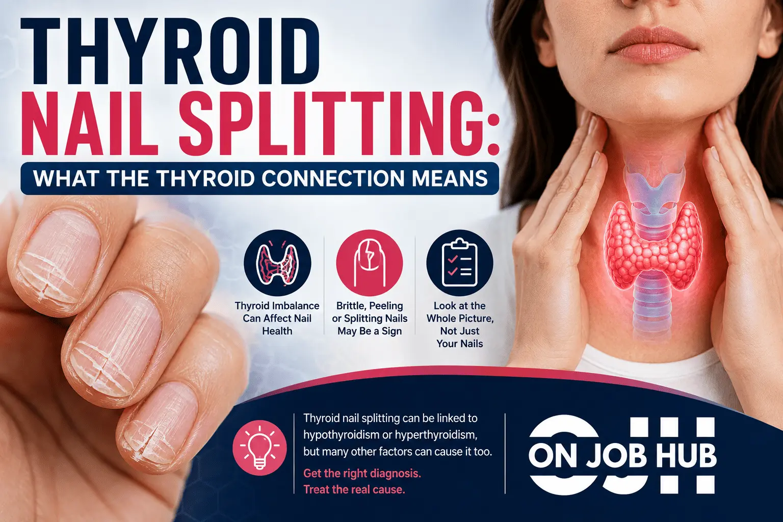 Thyroid Nail Splitting
