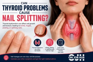Thyroid Nail Splitting